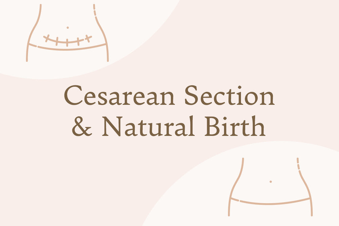 Illustration comparing cesarean section and natural birth. The image shows a simple line drawing of a lower abdomen with a C-section incision on top and a natural birth abdomen below, with the text “Cesarean Section & Natural Birth” in the center.