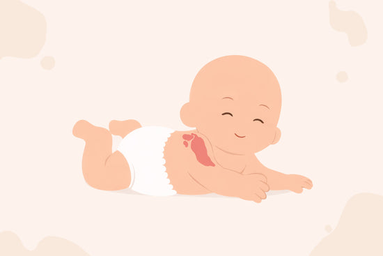 A happy, bald cartoon baby lies on its stomach, wearing a diaper, with a red birthmark on its left shoulder. The background is light beige.